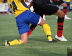 Sportunfall beim Fußball