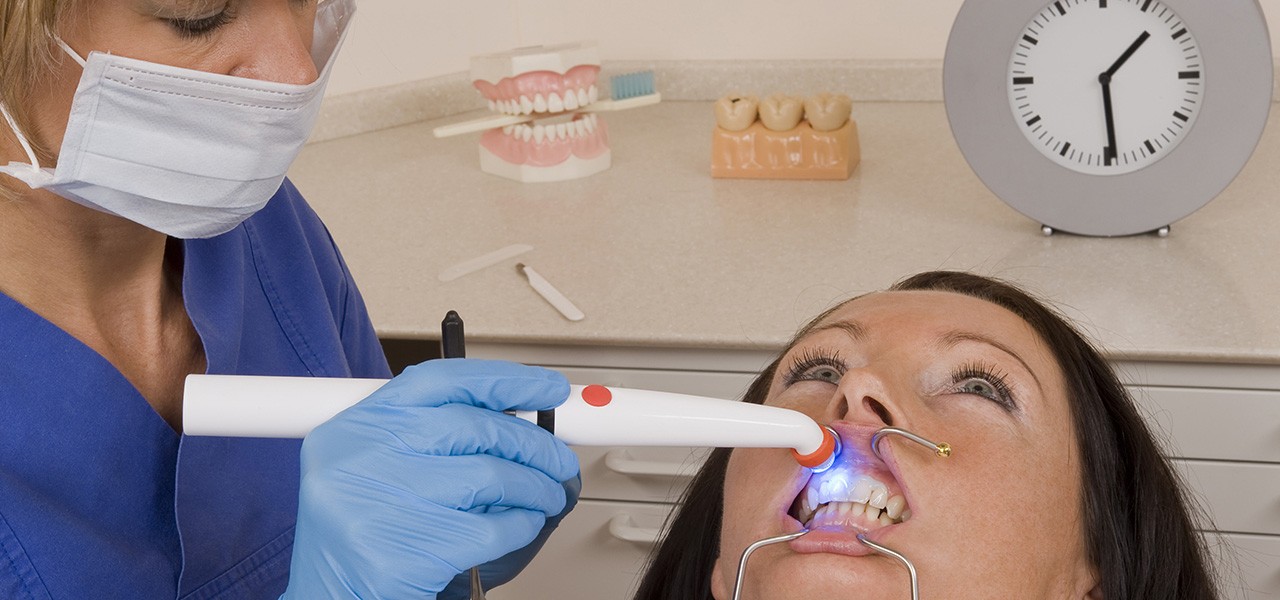 Professionelle Zahnaufhellung - Bleaching - beim Zahnarzt